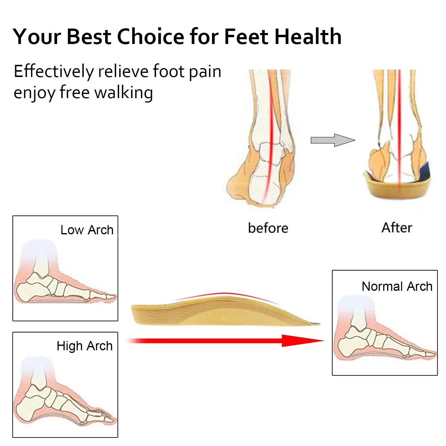 Arch Support, RooRuns 3/4 Orthotic Shoe Inserts for Over-Pronation, Plantar Fasciitis, Heel Pain Relief, High Arch Support Insoles for Men and Women for Running Walking M (Men's7-10.5, Women's8-11.5)